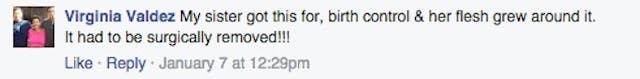 IUD, Planned Parenthood, surgically removed