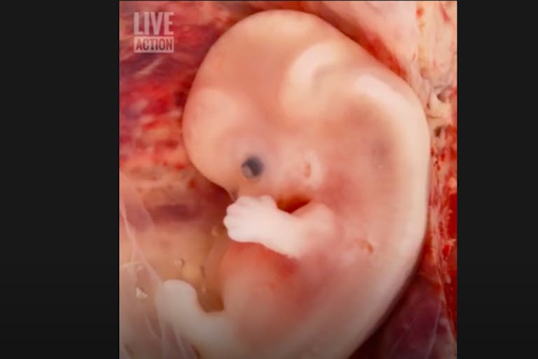 6 weeks, heartbeat, abortion, Planned Parenthood