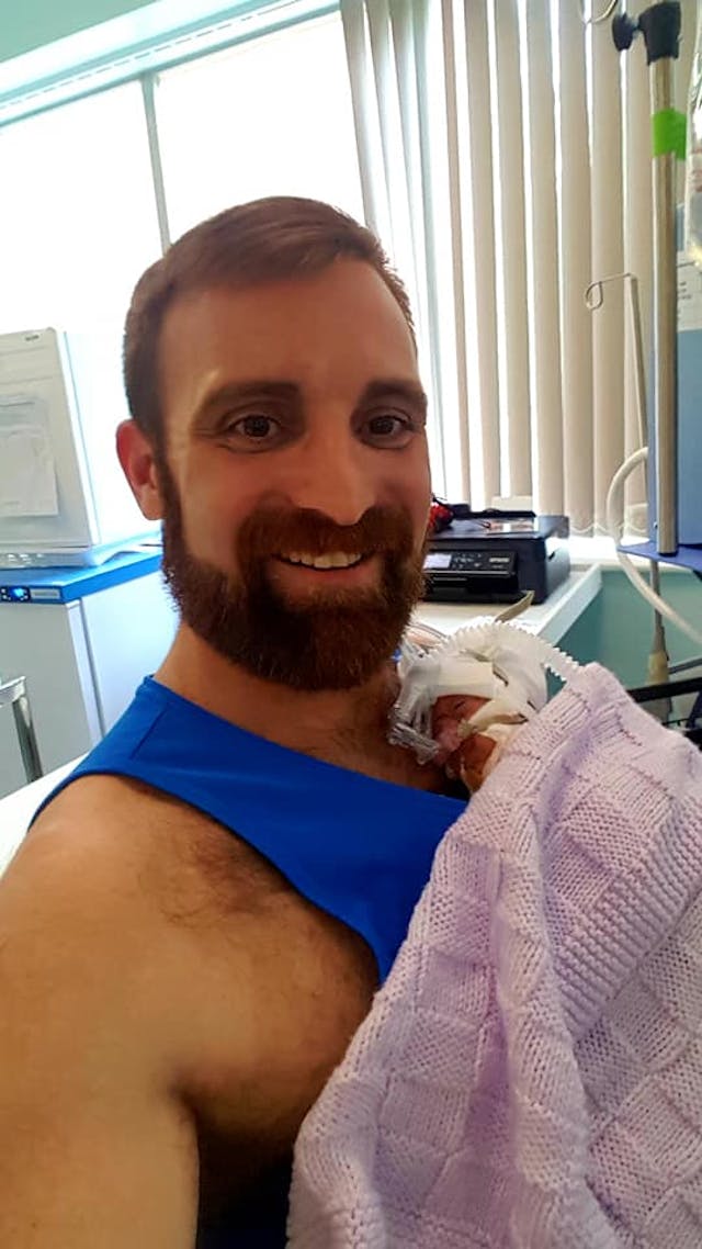 A tiny Susie who was born premature at just 22 weeks and four days gestation facebook