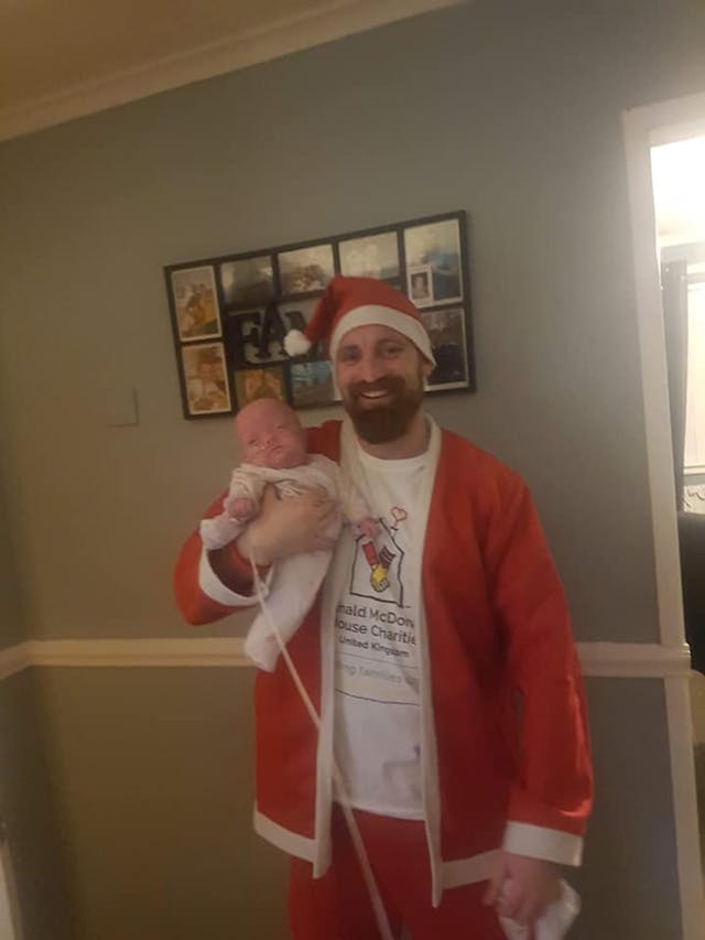 Baby Sussie, who was born premature at just 22 weeks and 4 days gestation, is pictured with her father Lee Patrick. facebook