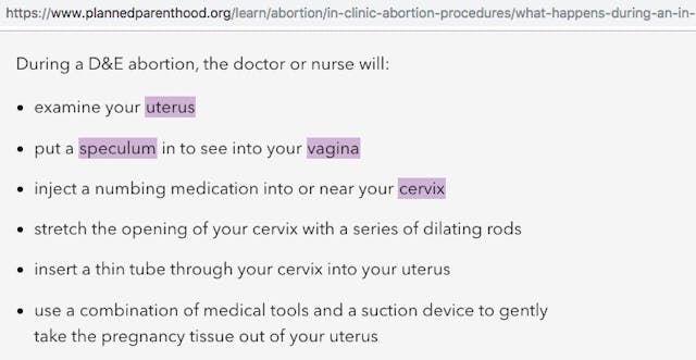 Not the full facts - Planned Parenthood D&E Abortion