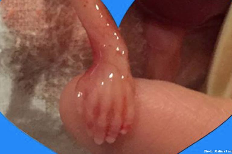 Baby Rylan, miscarried at 15 weeks