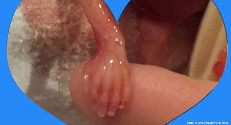 Baby Rylan, miscarried at 15 weeks