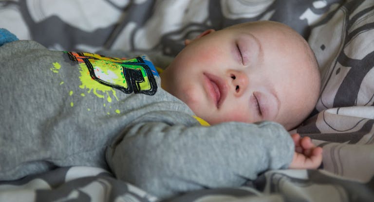 Close-Up Of Baby With Down Syndrome Sleeping On Bed