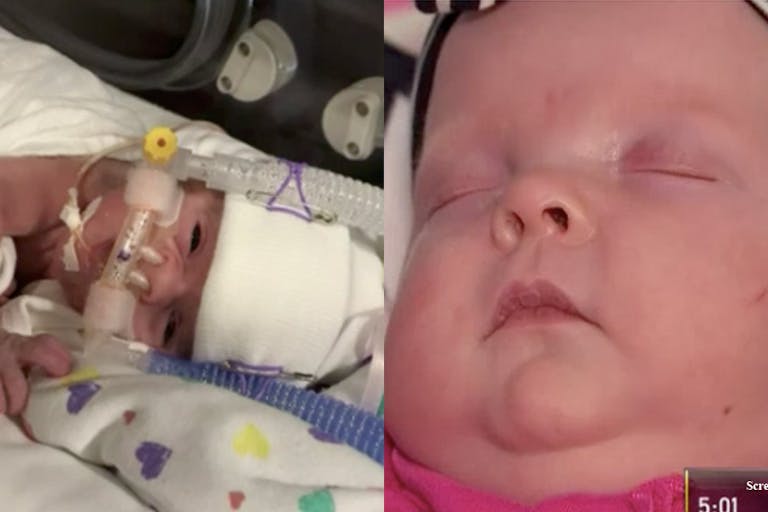 micro-preemie, preemie