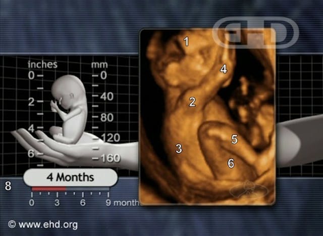 16 week preborn 16 week preborn