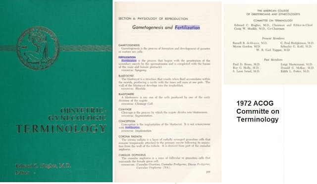 1972 ACOG committee on terminology changed definition of conception to implantation not fertilization Image: 1972 ACOG committee on terminology changed definition of conception to implantation not fertilization