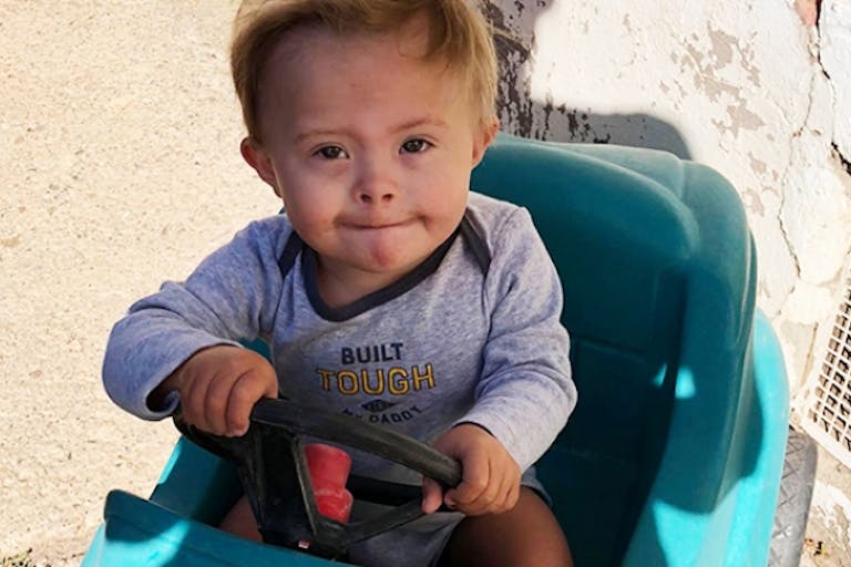 Down syndrome, abortion, pro-life