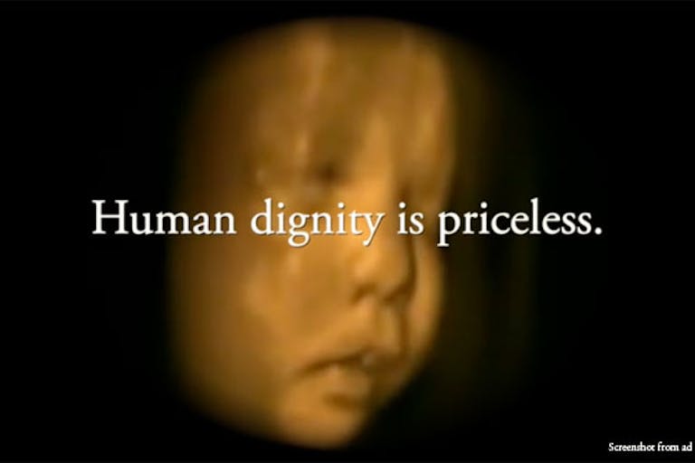 ultrasound-fetal-parts-ad-wisconsin