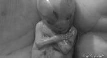 miscarried