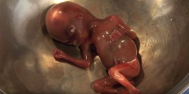 video-fetus-672x369