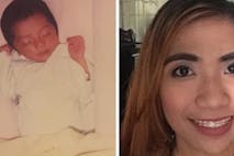 abortion survivor