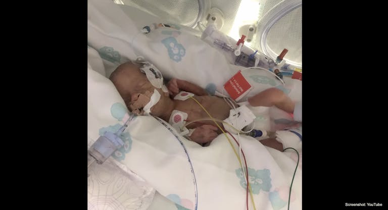 preemie