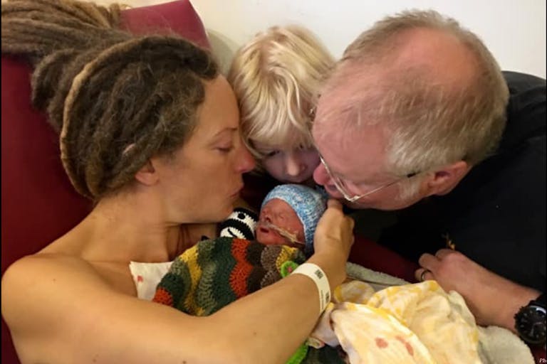 Trisomy 18