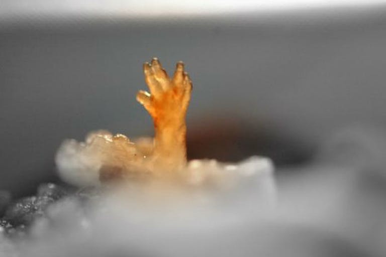 early abortion, A baby hand, pro-life, aborted