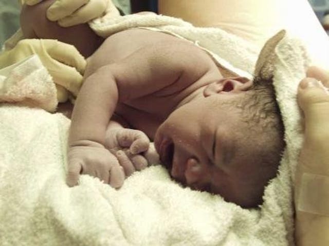 Ben just after his birth