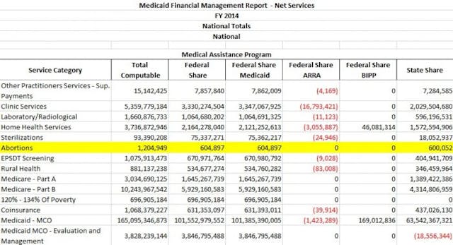Taxpayers contributed over a million dollars for abortions in 2014. Unearthed court documents show Planned Parenthood considers all abortions ‘medically necessary’ image