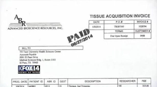 ABR invoices for fetal tissue to Texas Universities Image: ABR invoices for fetal tissue to Texas Universities