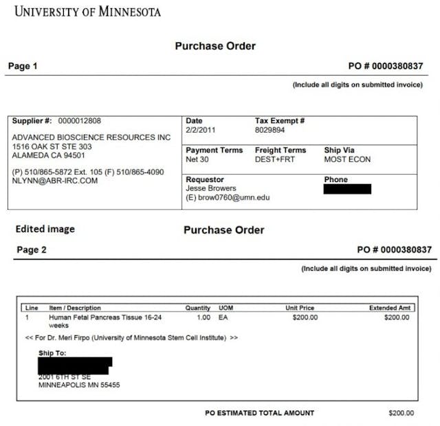 ABR contract with U of Minnesota for fetal tissue 2011 Image: ABR contract with U of Minnesota for fetal tissue 2011