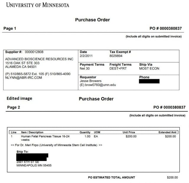 Image: ABR contract with U of Minnesota for fetal tissue 2011