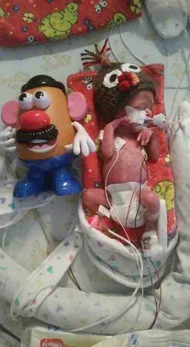 Photo via premature baby Winston Rochat