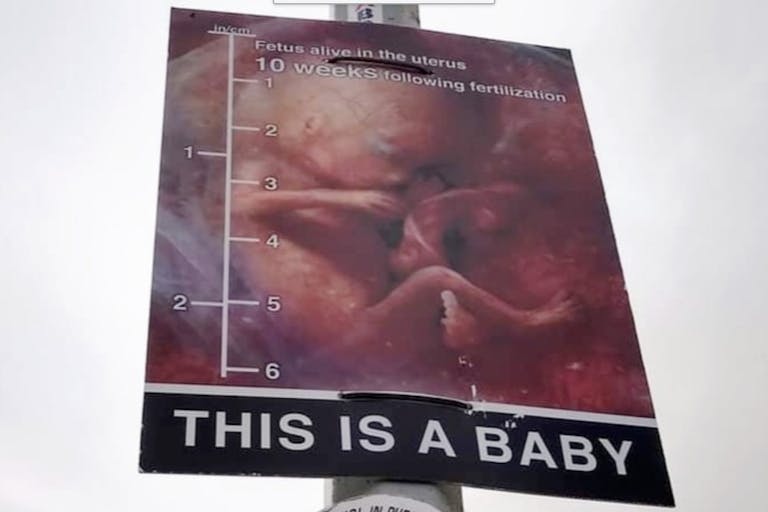 10 weeks Northern Ireland