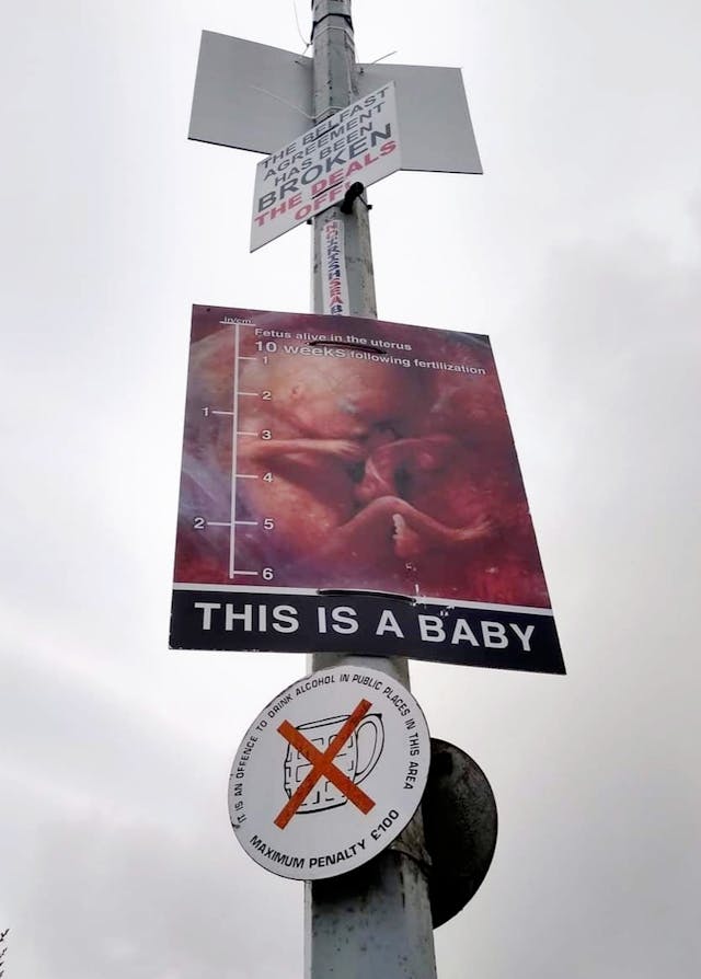 Photo of living 10-week preborn baby is ‘vile imagery,’ says Northern Ireland politician image