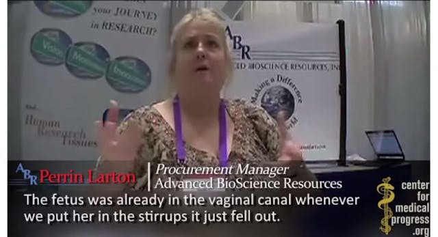 videos exposed Planned Parenthood's fetal parts business