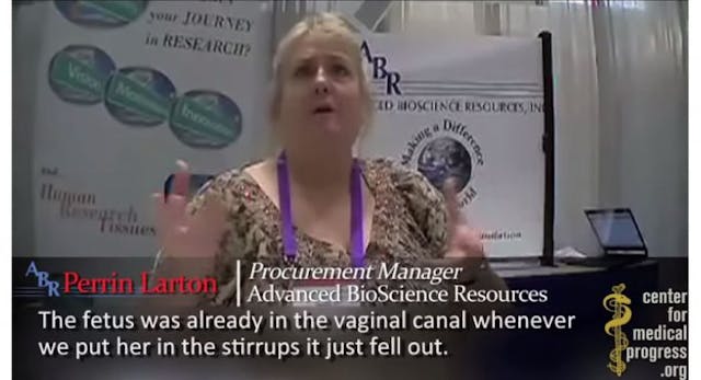 videos exposed Planned Parenthood's fetal parts business