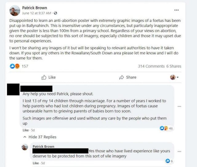 Photo of living 10-week preborn baby is ‘vile imagery,’ says Northern Ireland politician image