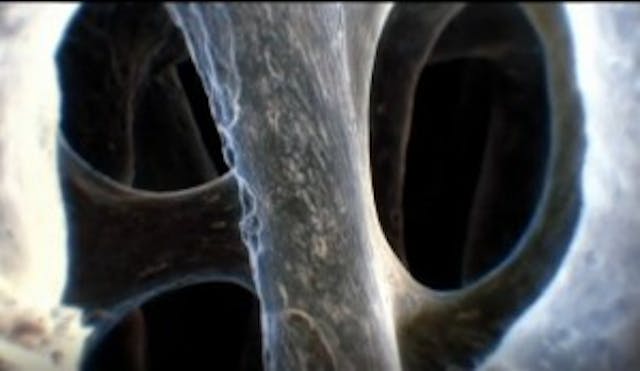 Human Bone credit: screen grab from Discovery video