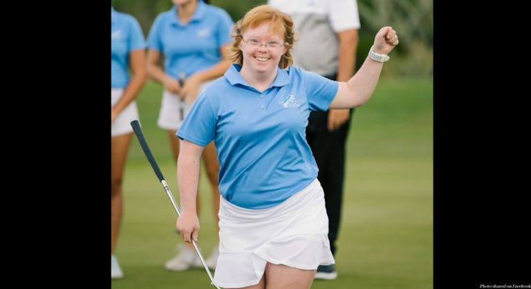 Down syndrome