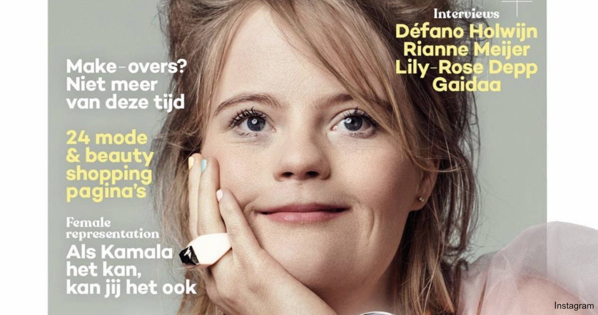 Model with Down syndrome to grace Glamour magazine’s Netherlands cover ...