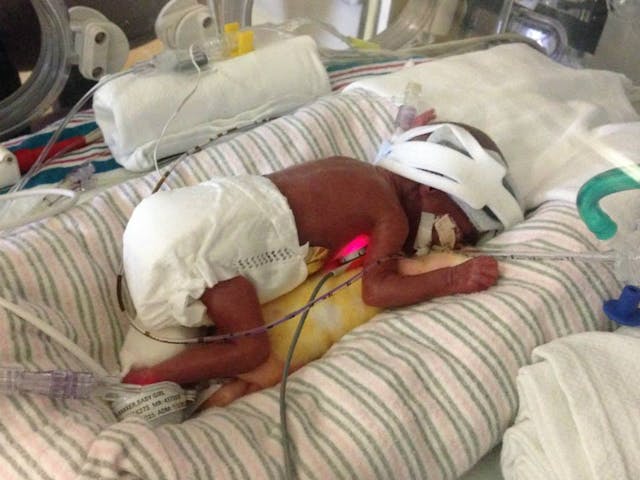 Baby Naomi in the NICU. Photo via Facebook.