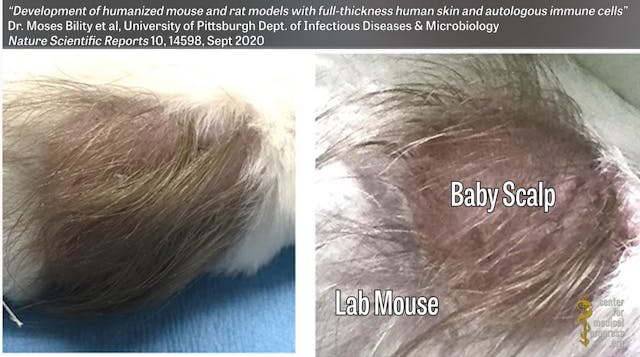 University of Pittsburgh study uses scalps of aborted babies on rodents (CMP vid) Image: University of Pittsburgh study uses scalps of aborted babies on rodents (CMP vid)
