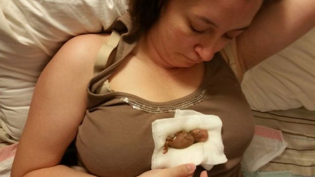 ester-garcia-1-miscarriage