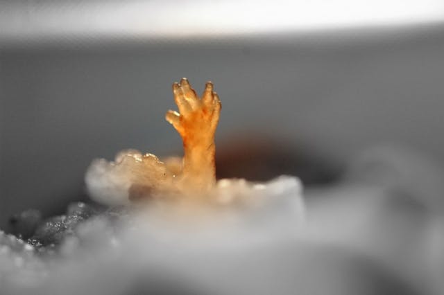 Abortion worker flees facility after seeing 16-week-old baby born alive image