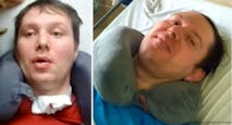 Joshua Barras, brain injury, dehydration