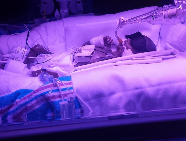 ‘Miracles exist,’ says mother of baby girl born premature at 22 weeks image