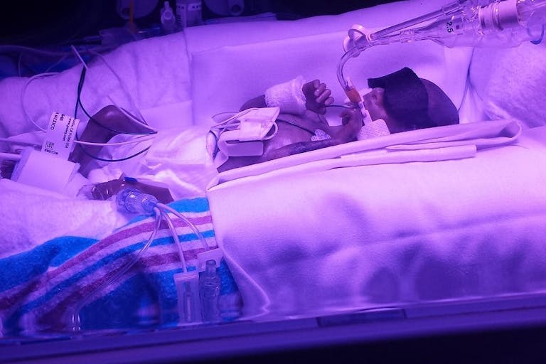 ‘Miracles exist,’ says mother of baby girl born premature at 22 weeks image