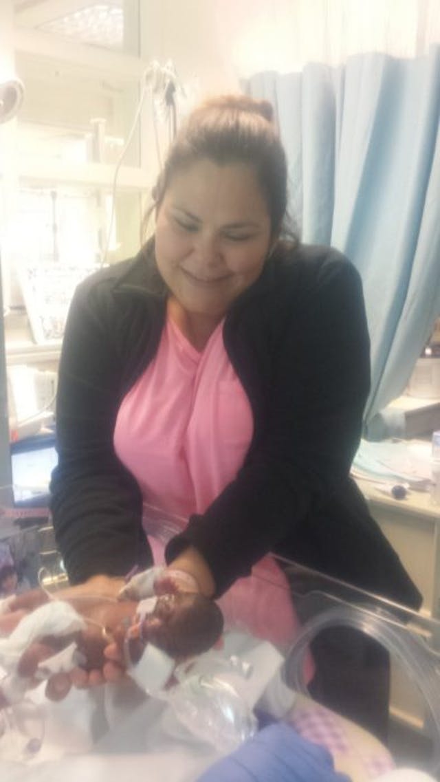 ‘Miracles exist,’ says mother of baby girl born premature at 22 weeks image