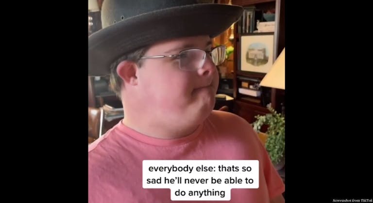 Down syndrome