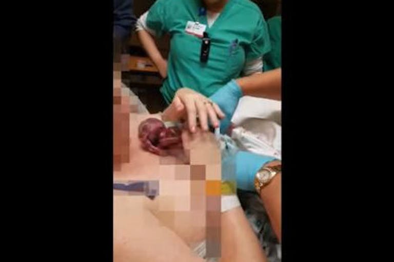 Prematuretwinbrothersdie