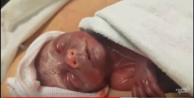 Baby Elliot was born premature and doctors refused to help him. Baby Elliot was born premature and doctors refused to help him.