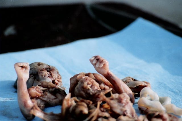 Ghazaleh Moayedi claims this is an 'act of love,' but this preborn baby's mutilated body shows how violent second-trimester abortions are.