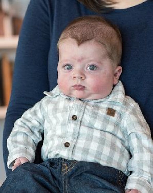 Oliver Kalivas (photo via Children’s Colorado Foundation) heart