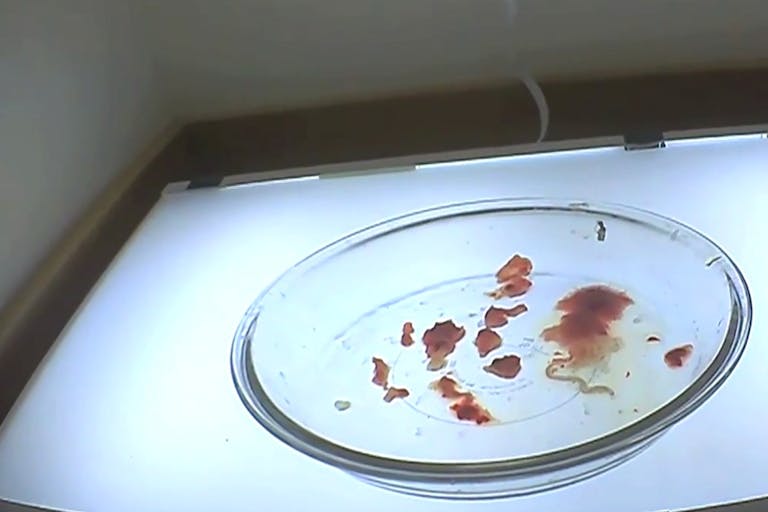 planned-parenthood-aborted-baby-parts