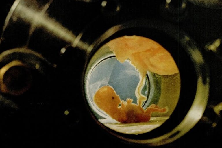 10 week old Fetus kept alive via artificial womb (Image credit: Life Magazine Sep 10, 1965) experimentation on abortion survivors