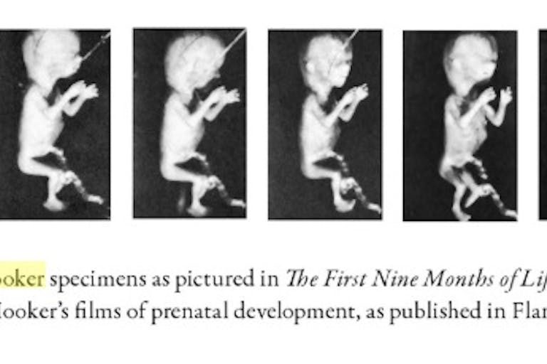 Davenport Hooker fetal specimens featured in First Nine Months of Life (Image credit: Icons of Life: A Cultural History of Human Embryos) experimentation on abortion survivors