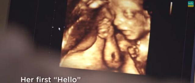 Pampers, ultrasound